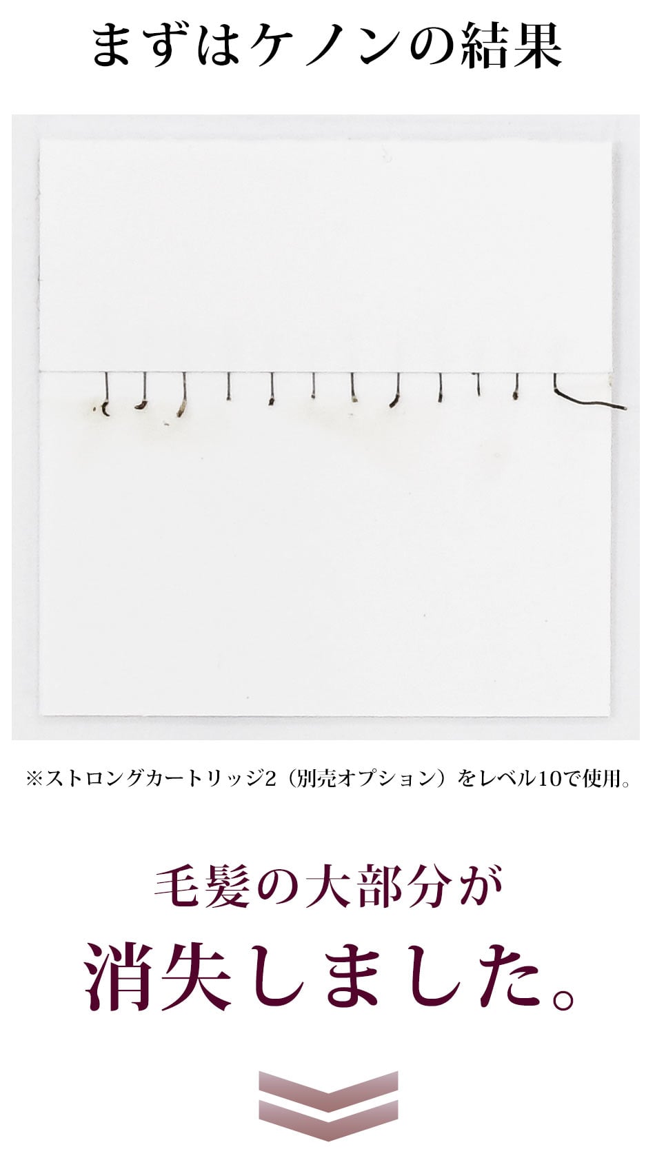 まずはケノンの結果