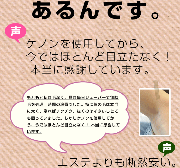 ユーザーの声1
