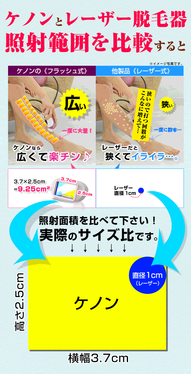 レーザーから乗り換え
