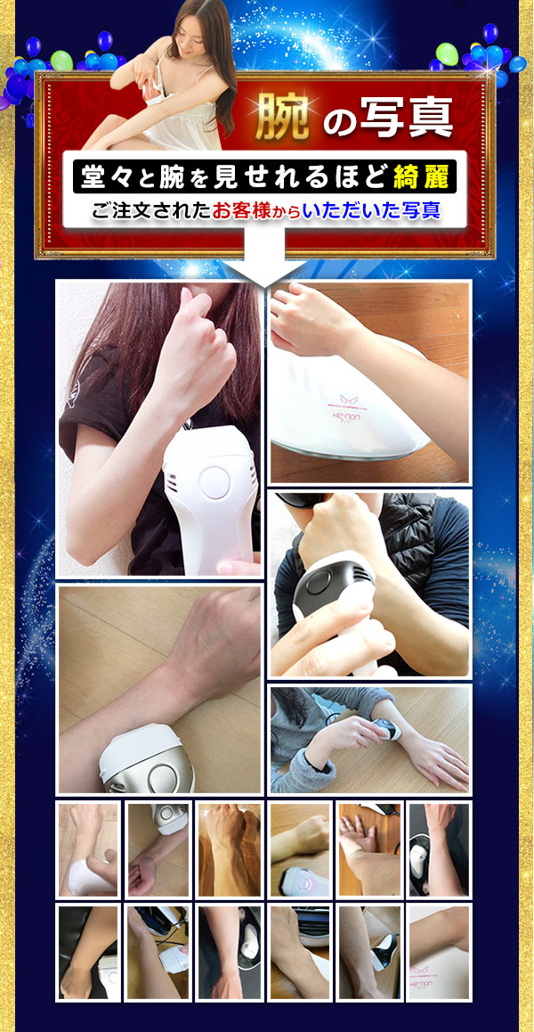 腕の写真をご紹介します。