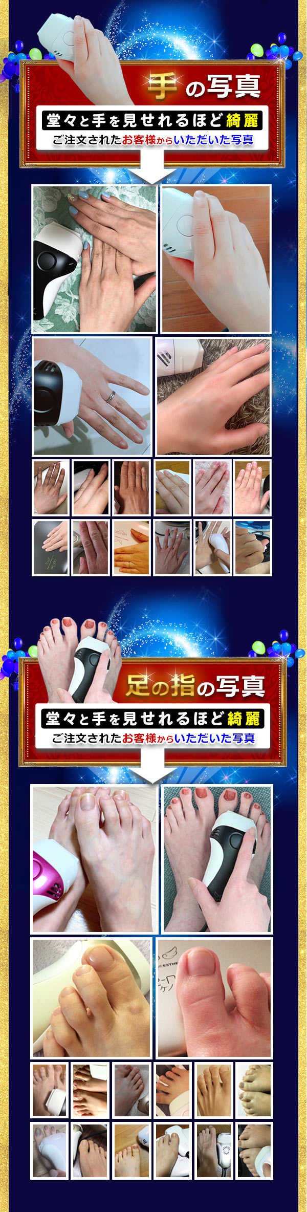 手の写真をご紹介します。